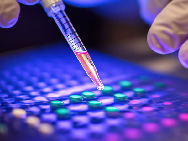 Metabolomics Data Analysis